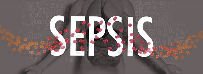 sepsis image